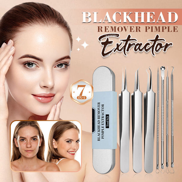 💓HOT SALE 50% OFF💥Stainless Steel Blackhead Remover Tool Kit Main image